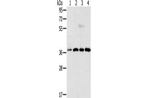 Gel: 12 % SDS-PAGE, Lysate: 40 μg, Lane 1-4: Hela cells, Jurkat cells, 293T cells, 231 cells, Primary antibody: ABIN7193012(VEGFA Antibody) at dilution 1/300, Secondary antibody: Goat anti rabbit IgG at 1/8000 dilution, Exposure time: 50 seconds (VEGFA antibody)