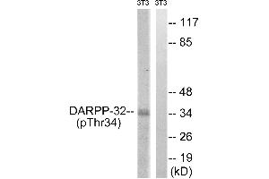 Immunohistochemistry analysis of paraffin-embedded human brain tissue using DARPP-32 (Phospho-Thr34) antibody.