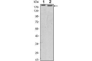 Western blot analysis using ERBB2 mouse mAb against SKBR3 (1) and MCF-7 (2) cell lysate. (ErbB2/Her2 antibody  (AA 750-987))