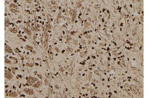 ABIN6277578 at 1/100 staining Rat brain tissue by IHC-P. (SERPINB3 antibody  (C-Term))