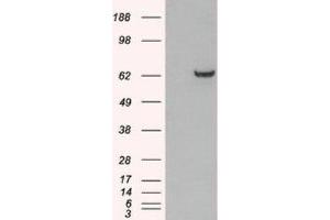 Western Blotting (WB) image for anti-Growth Factor Receptor-Bound Protein 7 (GRB7) (N-Term) antibody (ABIN2465793) (GRB7 antibody  (N-Term))