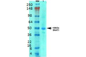 Western Blot analysis of Rat brain membrane lysate showing detection of SLC38A1 protein using Mouse Anti-SLC38A1 Monoclonal Antibody, Clone S104-32 . (SLC38A1 antibody  (AA 1-63) (Biotin))