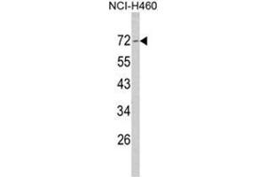 Western blot analysis of Merlin Antibody (N-term) in NCI-H460 cell line lysates (35ug/lane). (Merlin antibody  (N-Term))