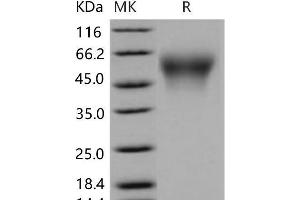 Western Blotting (WB) image for CD34 (CD34) (Active) protein (His tag) (ABIN7320223) (CD34 Protein (CD34) (His tag))