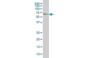 OXSR1 monoclonal antibody (M01), clone 2A2-1A2 Western Blot analysis of OXSR1 expression in A-431 . (OXSR1 antibody  (AA 1-527))