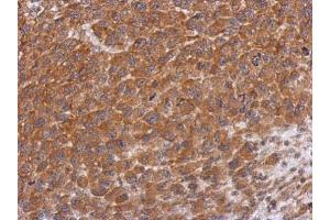 IHC-P Image Immunohistochemical analysis of paraffin-embedded H1299 xenograft, using Dysbindin, antibody at 1:500 dilution. (DTNBP1 antibody)