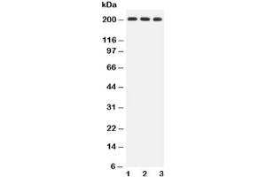 Western blot testing of BRCA1 antibody and Lane 1:  HeLa (BRCA1 antibody  (AA 1661-1863))