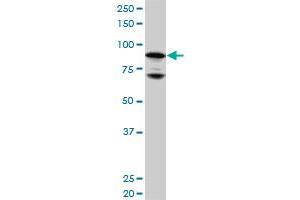 NR3C1 monoclonal antibody (M01), clone 2C8. (Glucocorticoid Receptor antibody  (AA 51-140))