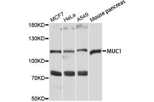 Western blot analysis of extracts of various cell lines, using MUC1 antibody (ABIN1873779) at 1:3000 dilution. (MUC1 antibody)