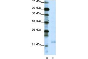 Western Blotting (WB) image for anti-TAF10 RNA Polymerase II, TATA Box Binding Protein (TBP)-Associated Factor, 30kDa (TAF10) antibody (ABIN2460218) (TAF10 antibody)