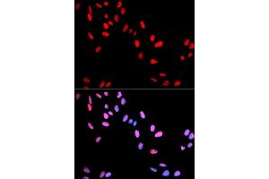 Immunofluorescence analysis of U2OS cells using Phospho-MYC-T58 antibody (ABIN5969925). (c-MYC antibody  (pThr58))