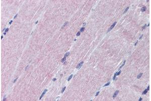 Human Skeletal Muscle (formalin-fixed, paraffin-embedded) stained with MAP2K6 antibody ABIN290187 at 1:50 followed by biotinylated goat anti-rabbit IgG secondary antibody ABIN481713, alkaline phosphatase-streptavidin and chromogen. (MAP2K6 antibody  (N-Term))