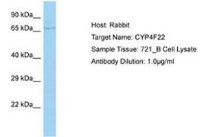 Image no. 1 for anti-Cytochrome P450, Family 4, Subfamily F, Polypeptide 22 (CYP4F22) (AA 207-256) antibody (ABIN6750174) (CYP4F22 antibody  (AA 207-256))