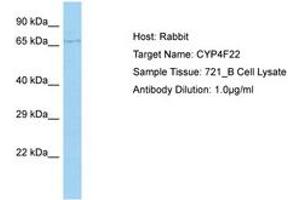 CYP4F22 antibody  (AA 207-256)