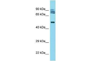 Western Blotting (WB) image for anti-Tripartite Motif Containing 64 (TRIM64) (N-Term) antibody (ABIN2791962) (TRIM64 antibody  (N-Term))