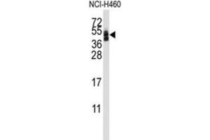 Western Blotting (WB) image for anti-Coxsackie Virus and Adenovirus Receptor (CXADR) antibody (ABIN3001668) (Coxsackie Adenovirus Receptor antibody)