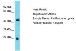 Image no. 1 for anti-Abhydrolase Domain Containing 4 (ABHD4) (AA 80-129) antibody (ABIN6750388) (ABHD4 antibody  (AA 80-129))