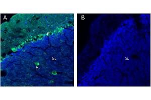 Glycine receptor β in mouse cerebellumA.