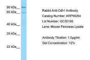 Western Blotting (WB) image for anti-Cadherin 1, Type 1, E-Cadherin (Epithelial) (CDH1) (C-Term) antibody (ABIN970364) (E-cadherin antibody  (C-Term))