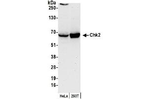 Western Blotting (WB) image for anti-Checkpoint Kinase 2 (CHEK2) (AA 1-50) antibody (ABIN7451703)