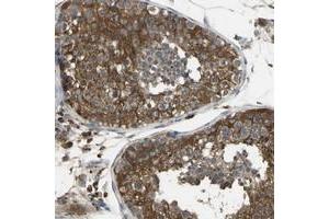 Immunohistochemical staining of human testis with DIAPH2 polyclonal antibody  shows cytoplasmic positivity in cells of seminiferus ducts at 1:500-1:1000 dilution. (DIAPH2 antibody)