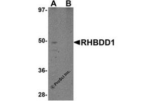 Western Blotting (WB) image for anti-Rhomboid Domain Containing 1 (RHBDD1) (C-Term) antibody (ABIN1030618) (RHBDD1 antibody  (C-Term))