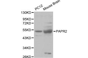 Western blot analysis of various cell lines, using PARK2 antibody. (Parkin antibody)
