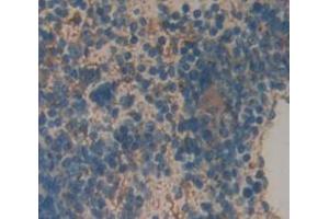 Used in DAB staining on fromalin fixed paraffin- embedded Kidney tissue (VSNL1 antibody  (AA 39-184))
