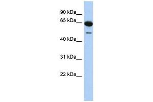 DAZ1 antibody used at 1 ug/ml to detect target protein. (DAZ1 antibody  (N-Term))