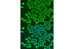 Immunofluorescence analysis of U2OS cells using TUBGCP3 antibody. (TUBGCP3 antibody  (AA 1-250))