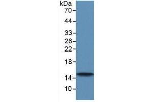 WB of Protein Standard: different control antibodies  against Highly purified E. (TGFB1 ELISA Kit)
