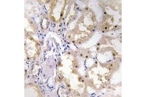 Immunohistochemical analysis of Granzyme H staining in human kidney formalin fixed paraffin embedded tissue section. (GZMH antibody  (Center))