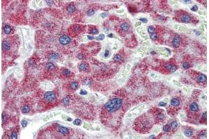 Liver, Human: Formalin-Fixed, Paraffin-Embedded (FFPE) (ACAA1 antibody  (AA 36-85))