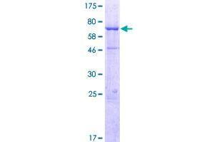 WDR19 Protein (AA 1-437) (GST tag)