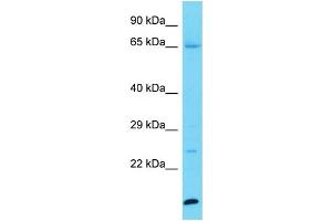 Host: Rabbit Target Name: KPRP Sample Type: Jurkat Whole Cell lysates Antibody Dilution: 1. (KPRP antibody  (C-Term))