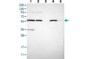 Western blot analysis of Lane 1: RT-4, Lane 2: U-251 MG, Lane 3: Human Plasma, Lane 4: Liver, Lane 5: Tonsil with MBOAT2 polyclonal antibody . (MBOAT2 antibody)