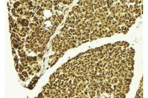 ABIN6276391 at 1/100 staining Mouse pancreas tissue by IHC-P. (SMNDC1 antibody)