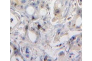 Used in DAB staining on fromalin fixed paraffin-embedded pancreas tissue (REG3A antibody  (AA 25-142))