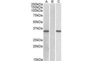 HEK293 lysate (10µg protein in RIPA buffer) overexpressing Human CRISP2 with C-terminal MYC tag probed with AP21266PU-N CRISP2 Antibody (1 µg/ml) in Lane A and probed with anti-MYC Tag (1/1000) in lane C.