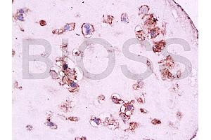Formalin-fixed and paraffin embedded human placenta tissue labeled with Anti-CD105 Polyclonal Antibody, Unconjugated at 1:200, followed by conjugation to the secondary antibody and DAB staining