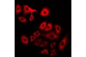 Immunofluorescent analysis of Myosin 1 staining in U2OS cells. (MYH1 antibody)