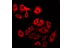 Immunofluorescent analysis of Myosin 1 staining in U2OS cells.