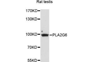 Western blot analysis of extracts of rat testis, using PLA2G6 antibody (ABIN5996267) at 1/1000 dilution. (PLA2G6 antibody)