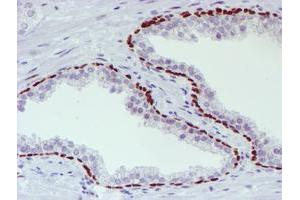 Image no. 1 for anti-WW Domain Containing Transcription Regulator 1 (WWTR1) antibody (ABIN1501763) (WWTR1 antibody)