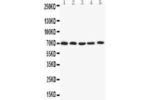 anti-Potassium Voltage-Gated Channel, Shaker-Related Subfamily, Member 4 (KCNA4) (AA 329-344), (Middle Region) antibody