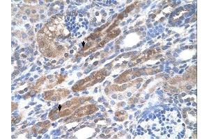 Immunohistochemistry (IHC) image for anti-KIAA0319 (KIAA0319) (N-Term) antibody (ABIN310884) (KIAA0319 antibody  (N-Term))