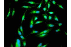 Immunofluorescence staining of Hela cells with ABIN7169132 at 1:266, counter-stained with DAPI. (PAK4 antibody  (AA 1-426))