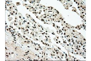 Image no. 1 for anti-TYRO3 Protein Tyrosine Kinase (TYRO3) antibody (ABIN1501608) (TYRO3 antibody)