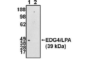 Image no. 1 for anti-Lysophosphatidic Acid Receptor 2 (LPAR2) (N-Term) antibody (ABIN265051) (EDG4 antibody  (N-Term))