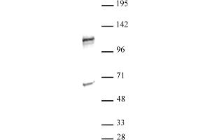 NFATC2 antibody (pAb) tested by Western blot.
